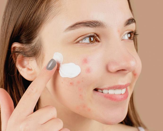 Niacinamida: beneficios y cómo integrar este ingrediente a tu rutina de skincare
